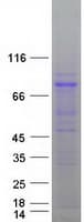 Human ZYG11B Protein (Recombinant Myc-DDK (Flag))