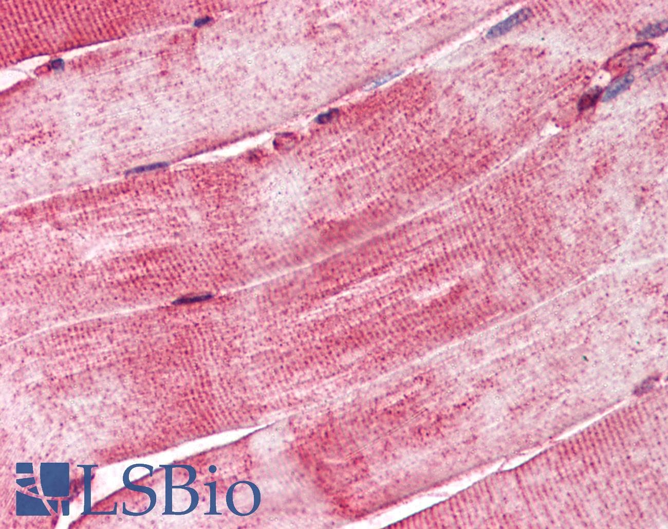 IHC-plus™ DNAJA3 / TID1 Antibody (C-Terminus)