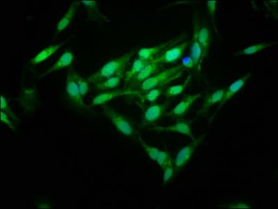 Polyclonal Rabbit anti-Human MID1IP1 Antibody (IHC)