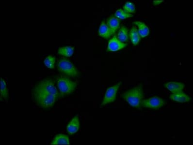 Polyclonal Rabbit anti-Human MRAP Antibody (IF)