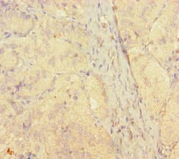 Polyclonal Rabbit anti-Human STAMBP / AMSH Antibody (WB)