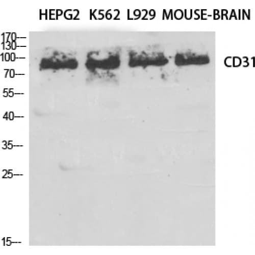 Polyclonal Rabbit anti-Human PECAM-1 / CD31 Antibody (660-740 aa, IHC, IF, WB)