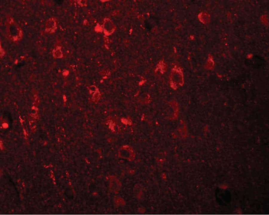 IHC-plus™ Polyclonal Rabbit anti-Human EFHD2 Antibody (IHC, IF, WB)