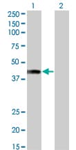 AF5Q31 / AFF4 Antibody (clone 2E12)
