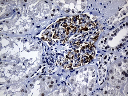 ELL / MEN Antibody (aa302-621, clone OTI5E12)