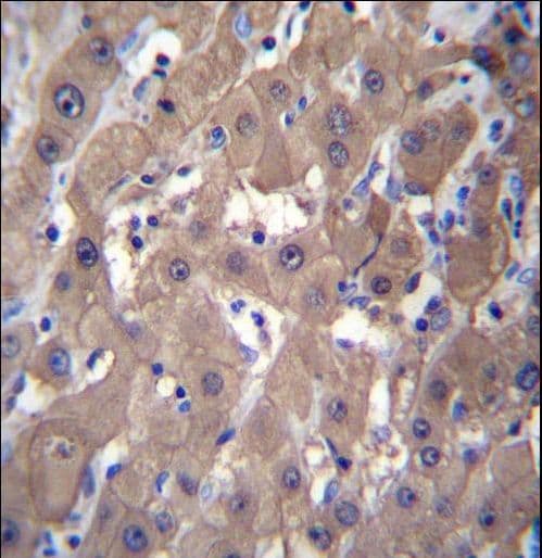 IHC-plus™ BABP / AKR1C2 Antibody (aa296-323)