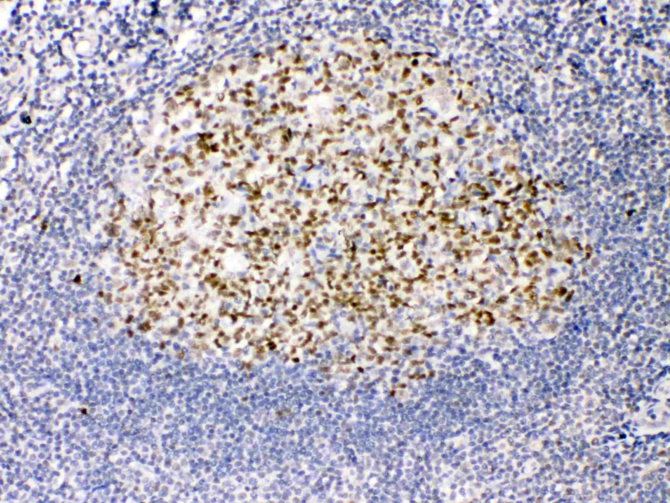 TERF2 / TRF2 Antibody (aa81-287)