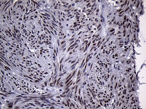 Monoclonal Mouse anti-Human RACGAP1 / MGCRACGAP Antibody (clone OTI4H8, aa123-238, IHC, WB)