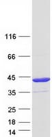 Human RRAD Protein (Recombinant Myc-DDK (Flag))