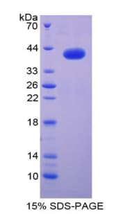 Mouse CCL3 / MIP-1-Alpha Protein (Recombinant His-GST)