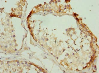 RPLP2 Antibody