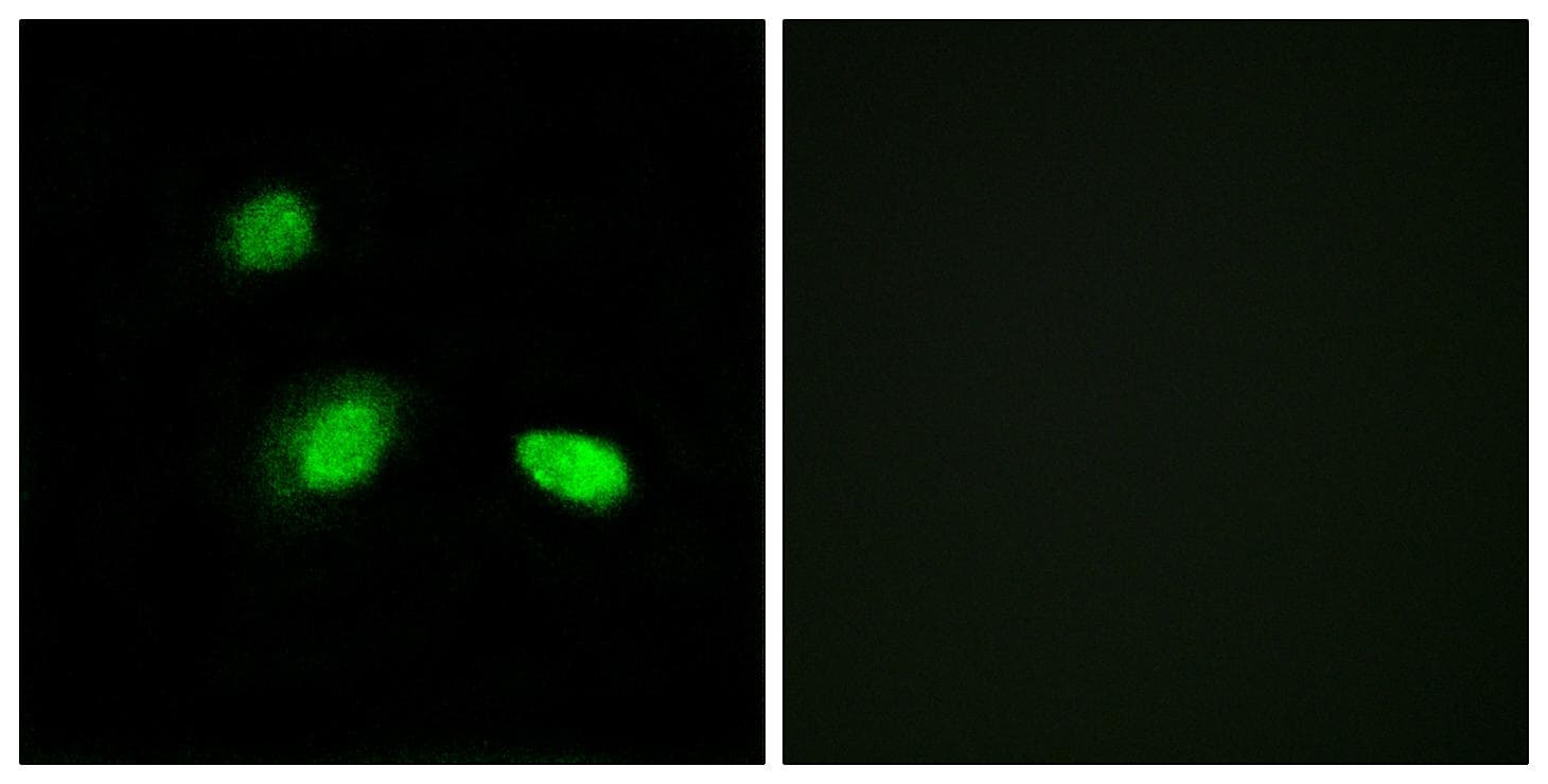 HSPB2 / HSP27 Antibody