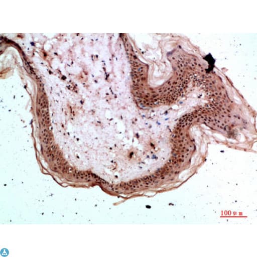 TPSD1 / Tryptase Delta 1 Antibody