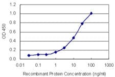 IHC-plus™ FOXK2 / ILF Antibody (clone 4A11)