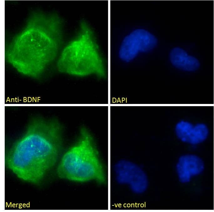 PathPlus™ Polyclonal Goat anti-Human BDNF Antibody (aa183-194, IHC, IF)
