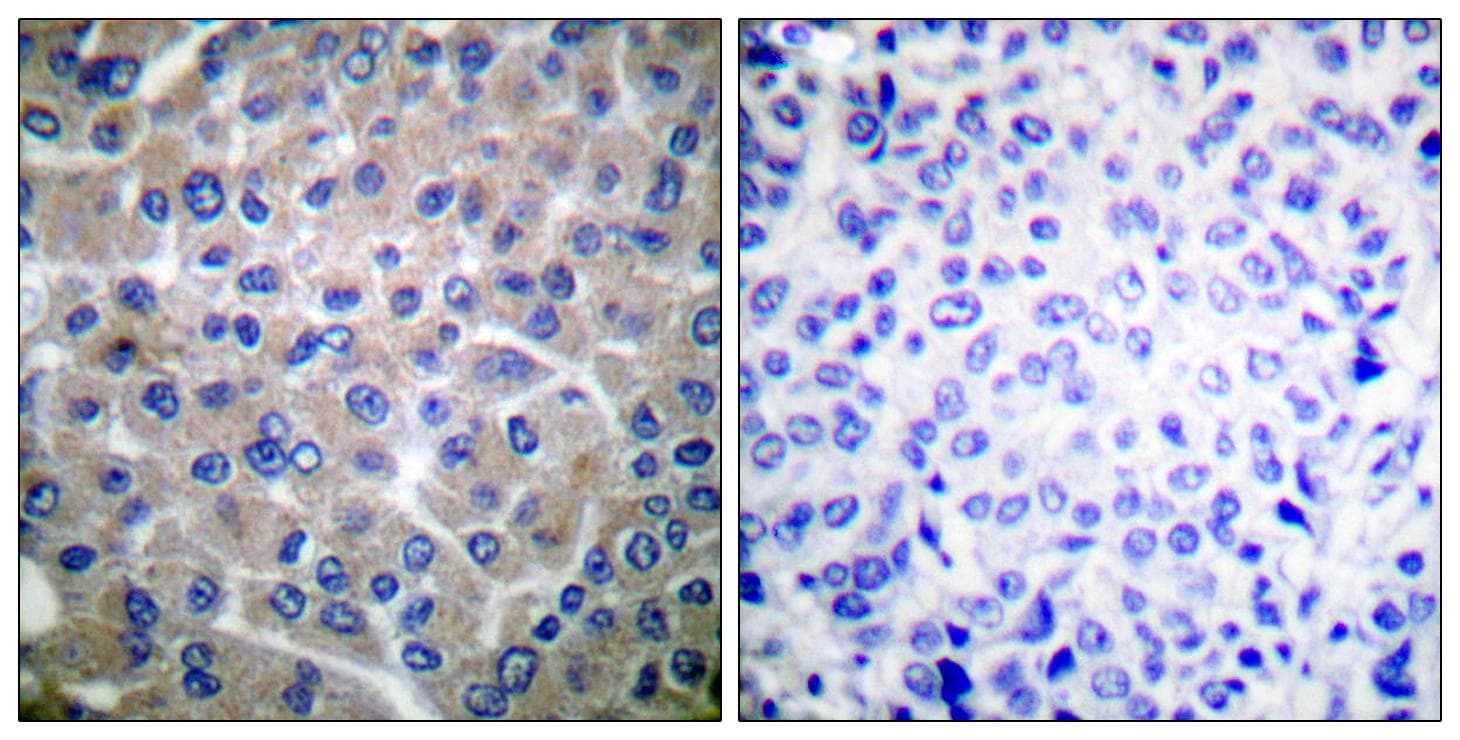 BCAR1 / p130Cas Antibody (p410)