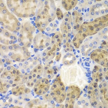 Polyclonal Rabbit anti-Human AKR1A1 Antibody (IHC, IF, WB)