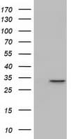 MAWDBP / PBLD Antibody (clone OTI2B5, Carrier-free)