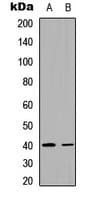 TSTA3 / GDP-L-Fucose Synthase Antibody (C-Terminus)