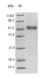 Human TTPA Protein (Recombinant 6His-SUMO, N-terminus)