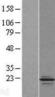 TPPP2 Protein (Over-Expression Lysate Myc-DDK (Flag))