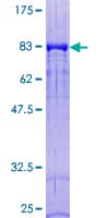 Human DOK1 Protein (Recombinant GST)