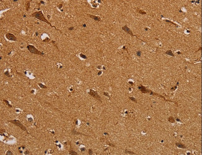NDUFS5 Antibody