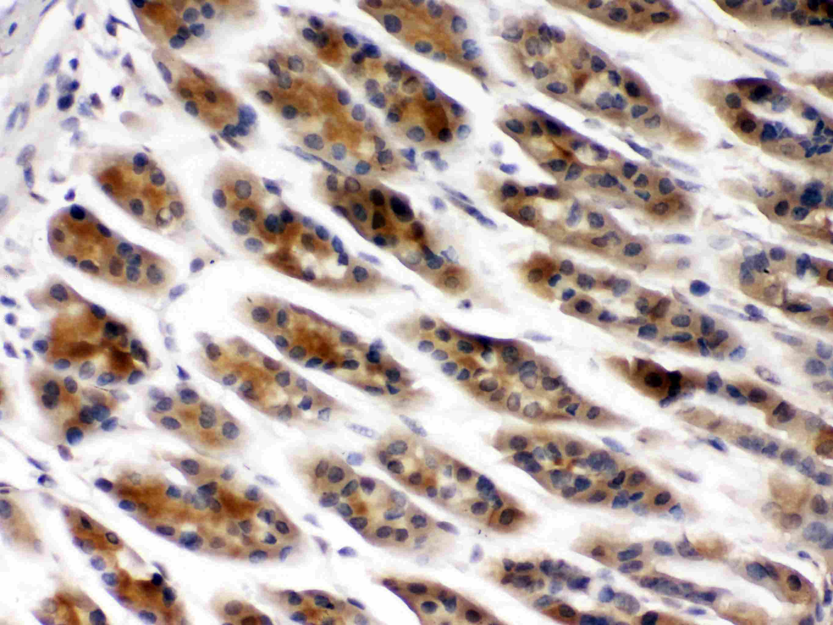 CCT2 / CCT Beta Antibody