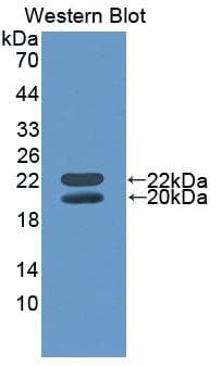 IGFBP3 Antibody (aa140-271)