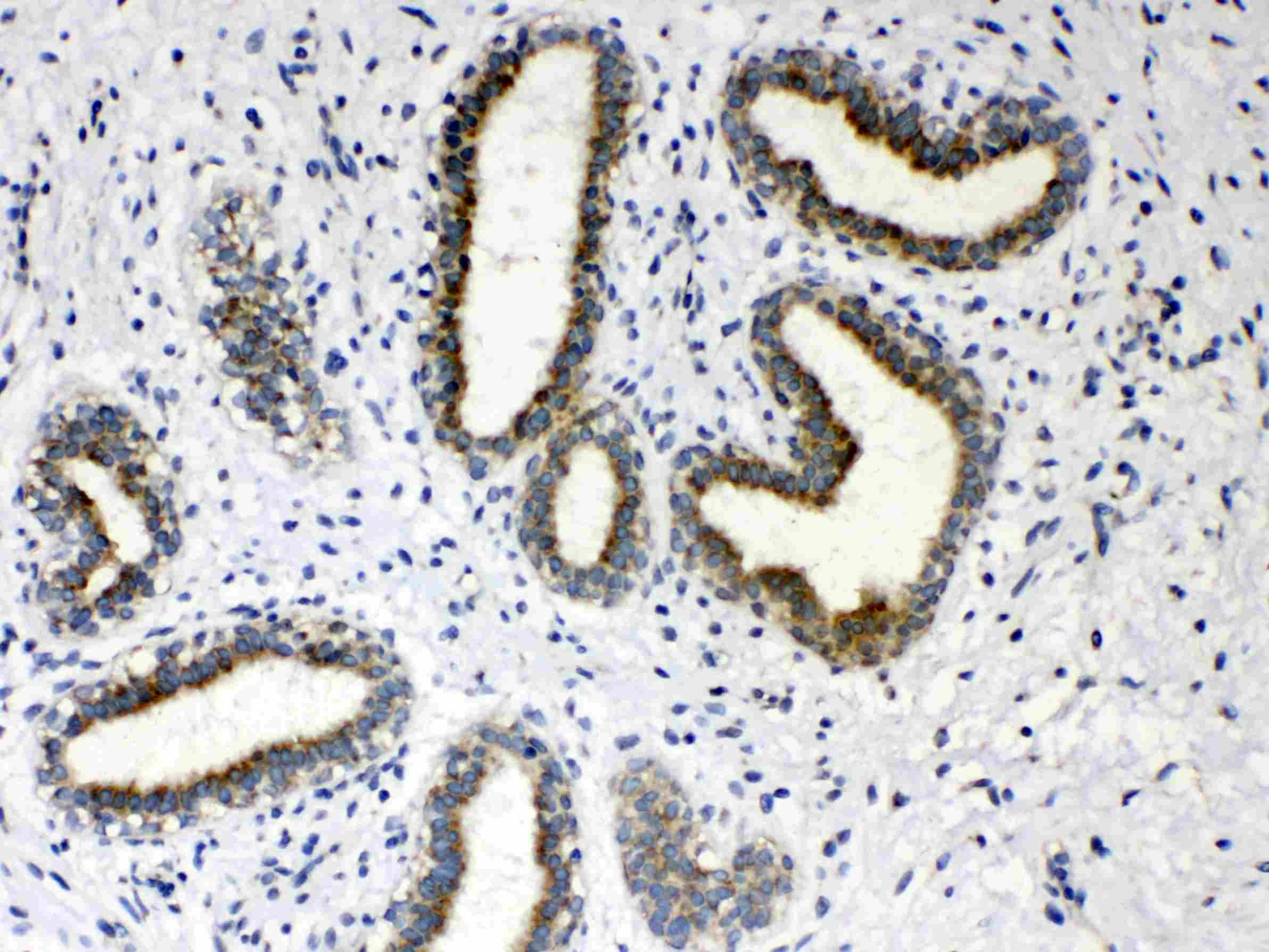 Polyclonal Rabbit anti-Human HSD17B4 Antibody (IHC, WB)