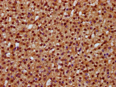 DHX38 Antibody