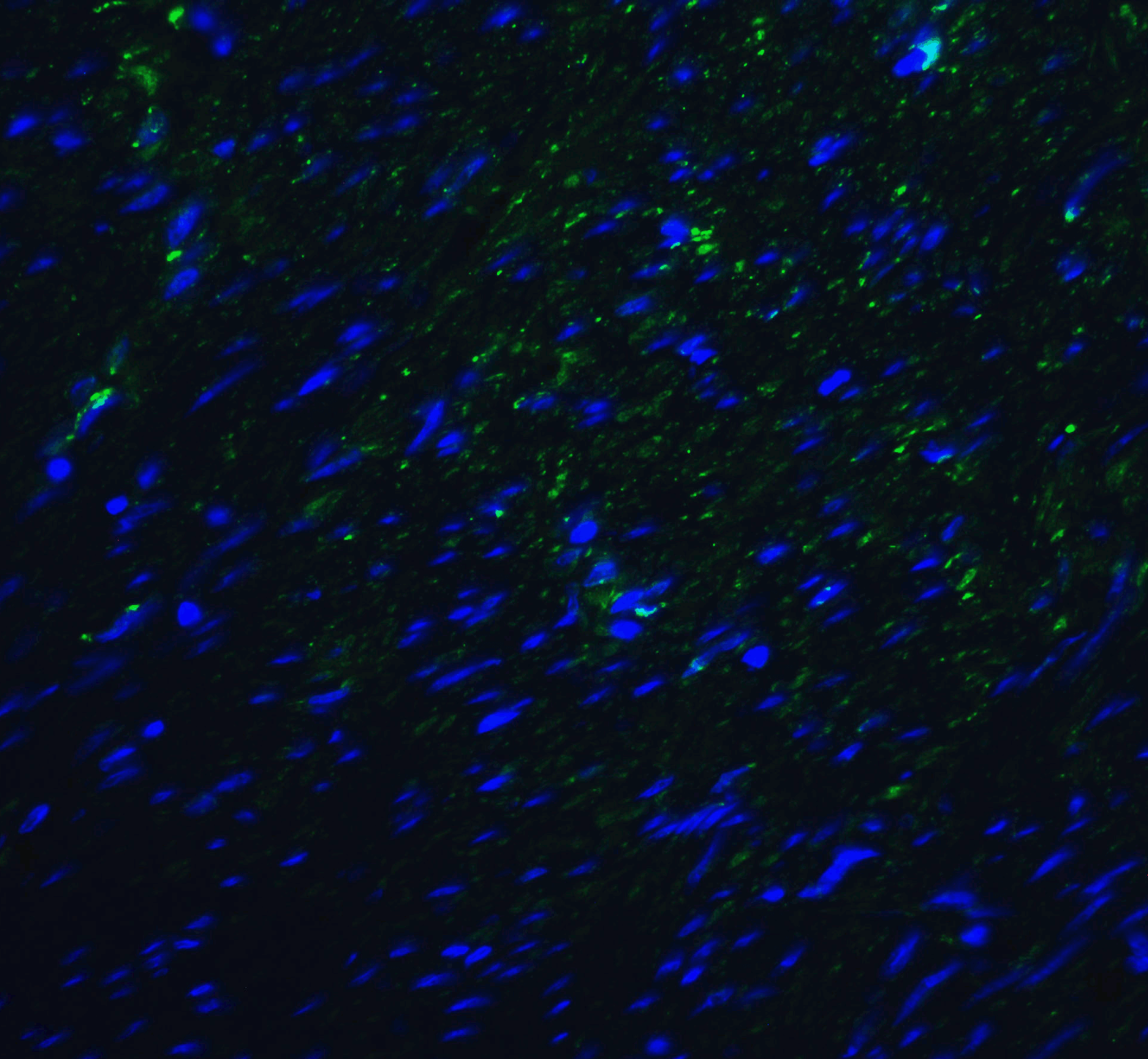 IHC-plus™ TMIGD2 Antibody (clone 8A1)