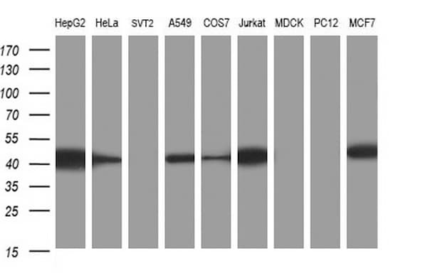 TXNDC5 / ERP46 Antibody (clone OTI1F6)