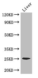 CIDEA / CIDE-A Antibody