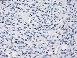 Monoclonal Mouse anti-Human FH / Fumarase / MCL Antibody (clone OTI1F10, IHC, IF, WB)