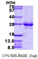 Human RAB14 Protein (Recombinant His)