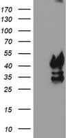 PDSS2 / DLP1 Antibody (clone OTI1D6)