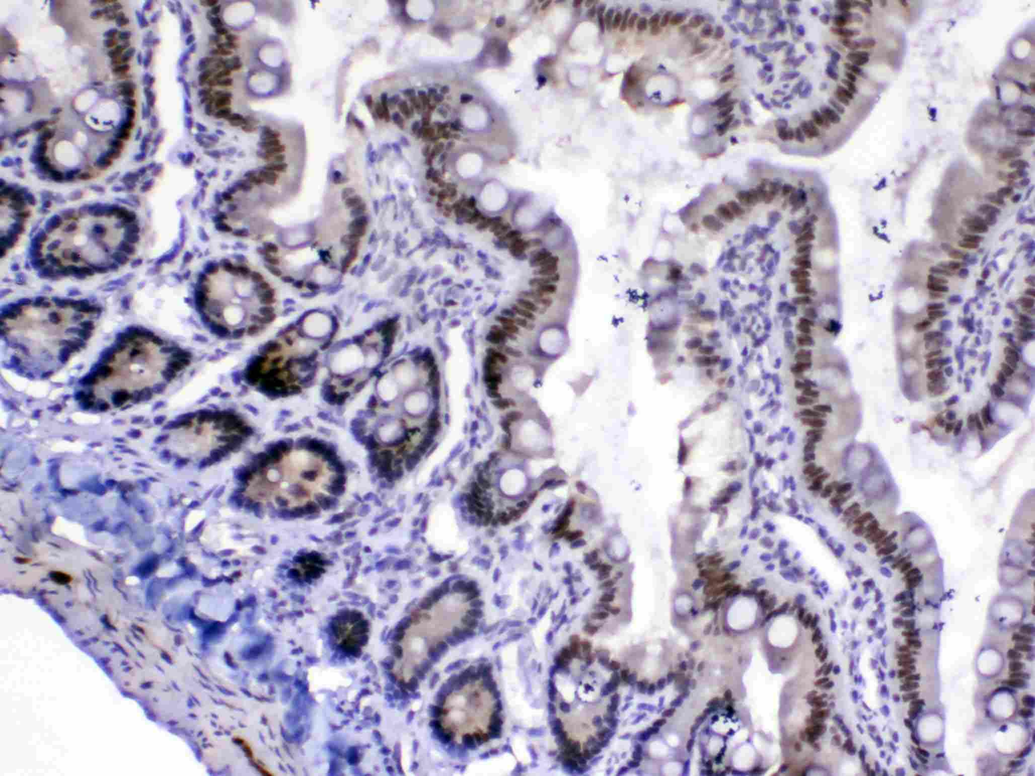 MED18 Antibody