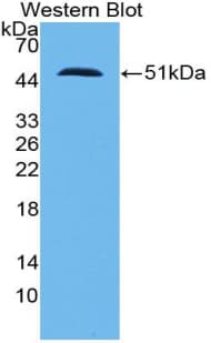 SFTPC / Surfactant Protein C Antibody (aa24-197, Biotin)