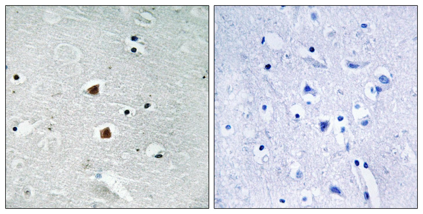 FOXJ3 Antibody