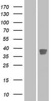 CDK20 / CCRK Protein (Over-Expression Lysate Myc-DDK (Flag))