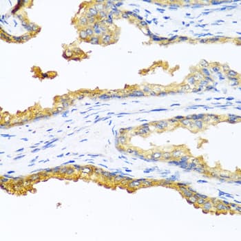 CPB2 / TAFI Antibody