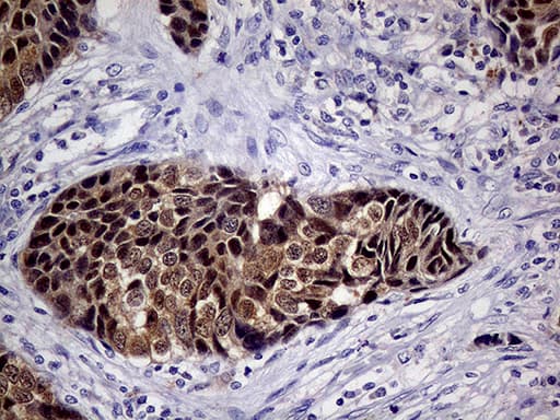 p16INK4a / CDKN2A Antibody (clone OTI11E9)