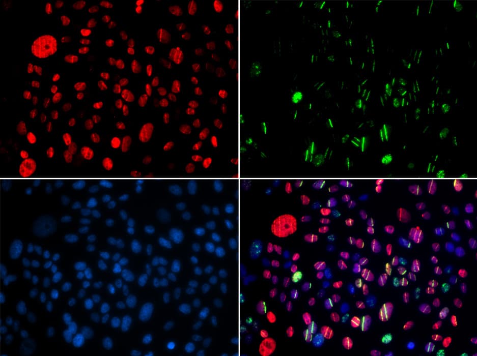 SMC1A / SMC1 Antibody (phospho-Ser957)
