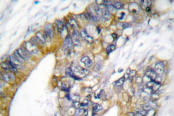 Polyclonal Rabbit anti-Human KRT18 / CK18 / Cytokeratin 18 Antibody (Thr410, IHC, IF, WB)