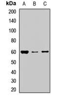 Polyclonal Rabbit anti-Human NOP58 / NOP5 Antibody (WB)
