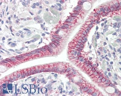 IHC-plus™ GPR52 Antibody