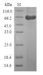Human CAPG Protein (Recombinant GST, N-terminus)