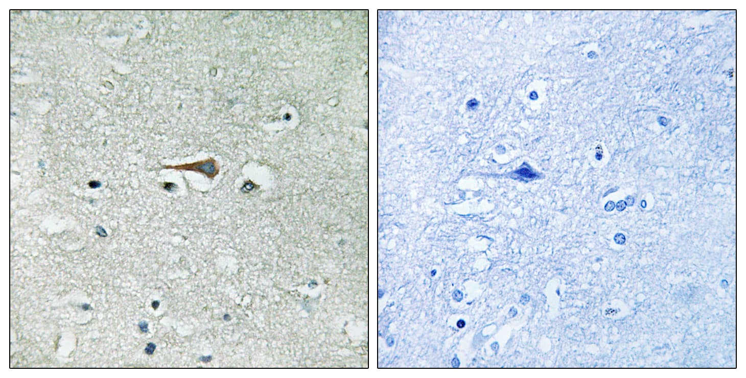 Polyclonal Rabbit anti-Human MPS1 / TTK Antibody (aa642-691, IHC, WB)