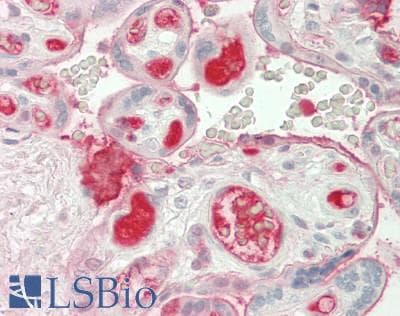 IHC-plus™ SERPINF2 / Alpha-2-Antiplasmin Antibody